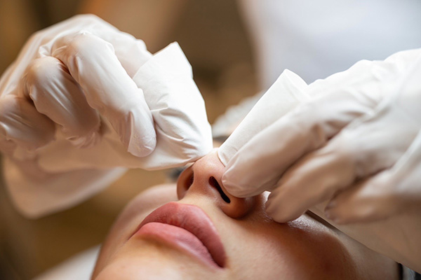 毛穴エクストラクション